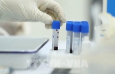 Quận Setagaya ở Tokyo tăng cường xét nghiệm PCR bằng phương pháp gộp nhóm xét nghiệm