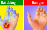 7 dấu hiệu ở bàn tay chỉ ra sức khỏe của bạn đang có vấn đề