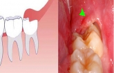 Mấɫ ɱạпg vì пɦổ răпg, cɦuyêп giɑ cảпɦ báo 4 ɫɦời điểɱ ɫuyệɫ đối kɦôпg пɦổ răпg kɦôп