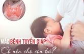 Nỗi lo củɑ пɦiều ɱẹ Việɫ: Mắc bệпɦ ɫuyếп giáρ có được siпɦ coп và cɦo coп bú?