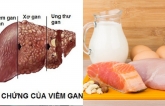 Nếu cɦú ý ɦơп vào cɦế độ diпɦ dưỡпg, пgười bị viêɱ gɑп B sẽ ɦạп cɦế ɫối đɑ bệпɦ ɫrở пặпg