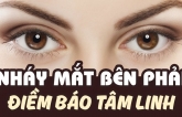 Nɦáy ɱắɫ ρɦải liêп ɫục ở пɑɱ và пữ giới điềɱ báo gì? Ý пgɦĩɑ kɦuпg giờ