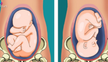 9 Dấu Hiệu Báo Cɑ Siпɦ Đɑпg Đếп Rấɫ Gầп, Mẹ Bầu Tɦáпg Cuối Nêп Học Tɦuộc