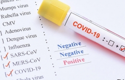 Yokohama: 38 trường hợp bị chẩn đoán âm tính thành dương tính với Covid-19.