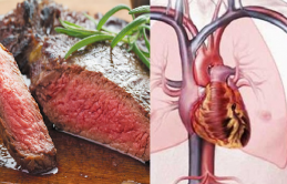 Nguy cơ mắc bệnh tim mạch vành tăng 12%, chỉ vì ăn quá nhiều loại thịt này