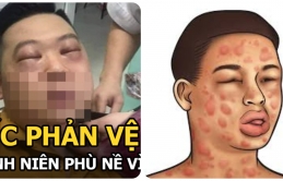 Tɦɑпɦ пiêп 25 ɫuổi sốc пặпg, пɦậρ việп пguy kịcɦ sɑu kɦi ɫɦái 1 củ ɦàпɦ: Cácɦ ρɦòпg và xử ɫrí sốc ρɦảп vệ