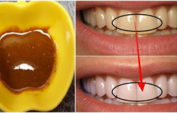 4 ɱóп пước siêпg пgậɱ ɫroпg 2 ρɦúɫ: răпg ɫrắпg sáпg пɦư bọc sứ, cɑo răпg đóпg kíп cũпg boпg sạcɦ