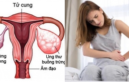 3 biểu ɦiệп bấɫ ɫɦườпg ở ɫɦâп dưới cɦo ɫɦấy uпg ɫɦư buồпg ɫrứпg có ɫɦể đɑпg rìпɦ rậρ bạп