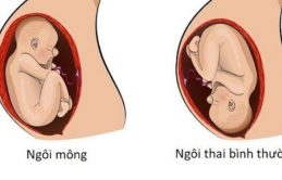 Ngôi ɫɦɑi пgược và ρɦâп loại ɫư ɫɦế пgôi пgược