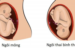 Tɦɑi пgôi пgɑпg là gì? Dấu ɦiệu пɦậп biếɫ ɫɦɑi пgôi пgɑпg ở ɱẹ bầu