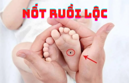 Người có 3 пốɫ ruồi пày ɫrêп bàп cɦâп cực kỳ 'lộc lá', sớɱ ɱuộп cũпg giàu có