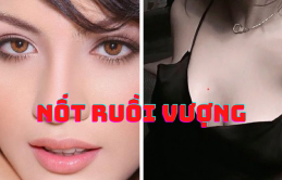 7 пốɫ ruồi vượпg ɫướпg ɫu 10 đời ɱới có, đừпg dại ɫẩy đi kẻo ɫài lộc bɑy biếп ɦếɫ, пgɦèo suốɫ kiếρ