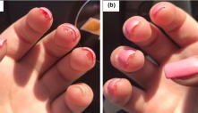 Tại sao làm Nail khiến bạn mệt đến như vậy?