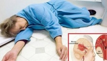 Đột quỵ hay xảy ra vào sáng sớm: Dừng ngay thói quen này để chặn đứng nguy cơ