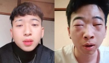 Phấn hoa - nỗi ám ảnh của người Việt ở nước ngoài