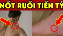 7 nốt ruồi là “thần may mắn”: Bất kể nam hay nữ có 1/7 Sướng Như Tiên