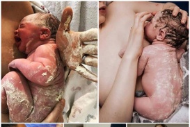 Supermom's Epic Journey: Remarkable Milk Pumping Triumph for Triplets