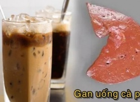 4 giờ vàng uống cà phê giúp cơ thể 'hưởng lợi' đủ đường, gan sạch độc, tiêu hóa trơn tru