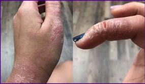 Cận cảnh đôi bàn tay nát bươm thấy thương của các thợ Nail