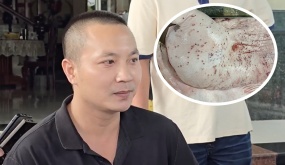 Đại diện C.P: Hình ảnh 'tố' heo bệnh là thật