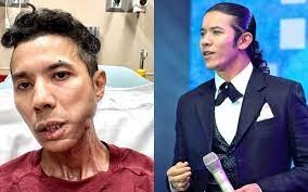 Tình trạng của Kasim Hoàng Vũ: Gầy rộc vì bạo bệnh, mệt mỏi run rẩy, mặt đau đớn không chịu nổi Tình trạng của Kasim Hoàng Vũ: Gầy rộc vì bạo bệnh, mệt mỏi run rẩy, mặt đau đớn không chịu nổi