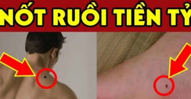 7 nốt ruồi là “thần may mắn”: Bất kể nam hay nữ có 1/7 Sướng Như Tiên 7 nốt ruồi là “thần may mắn”: Bất kể nam hay nữ có 1/7 Sướng Như Tiên